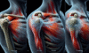 Acupuncture for Effective Frozen Shoulder Relief Techniques