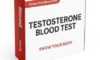 Testosterone Blood Test Guide: Essential Info for Slough Residents