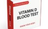Vitamin D Blood Test Guide: Key Information for Milton Keynes