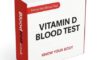 Vitamin D Blood Test: Why Canterbury Residents Should Care